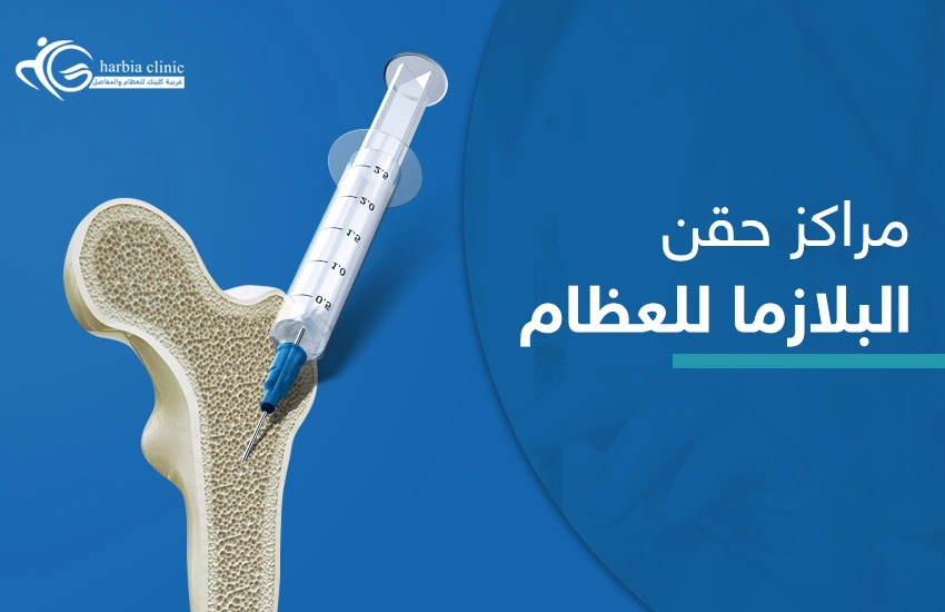 الخطوات التي تتبعها مراكز حقن البلازما للعظام