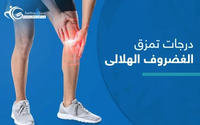 كل ما تحتاج معرفته عن درجات تمزق الغضروف الهلالي