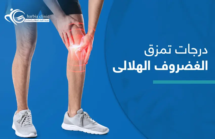 درجات تمزق الغضروف الهلالي