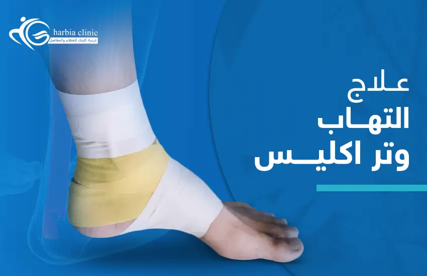علاج التهاب وتر أكيلس