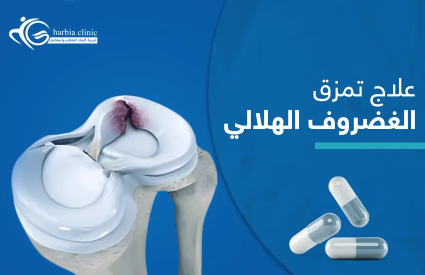 علاج تمزق الغضروف الهلالي