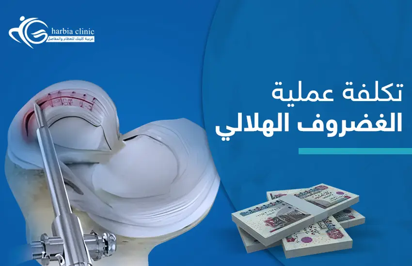 تكلفة عملية الغضروف الهلالي