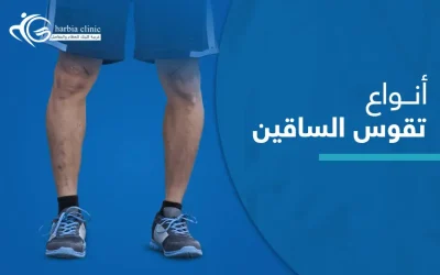 ما أنواع تقوس الساقين؟