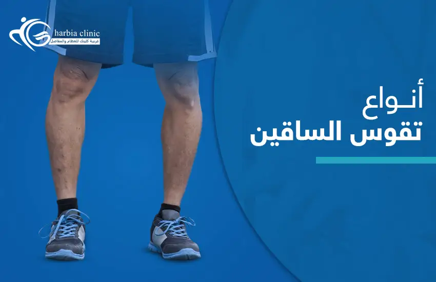 انواع-تقوس-الساقين أنواع تقوس الساقين