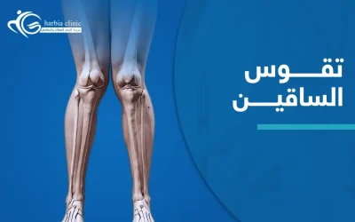 تقوس الساقين: متى يصبح الانحراف البسيط مشكلة حقيقية؟