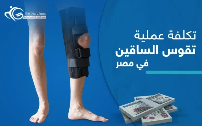 كيف تُحدد تكلفة عملية تقوس الساقين في مصر؟