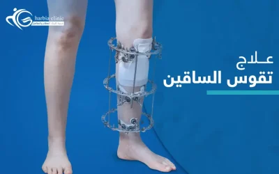 تعرف إلى سبل علاج تقوس الساقين