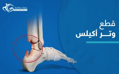 تعرف إلى أسباب قطع وتر أكيلس وعلاجه