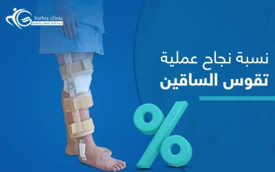 العوامل المؤثرة في نسبة نجاح عملية تقوس الساقين
