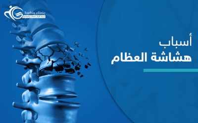 اسباب هشاشة العظام ونصائح هامة للوقاية منها