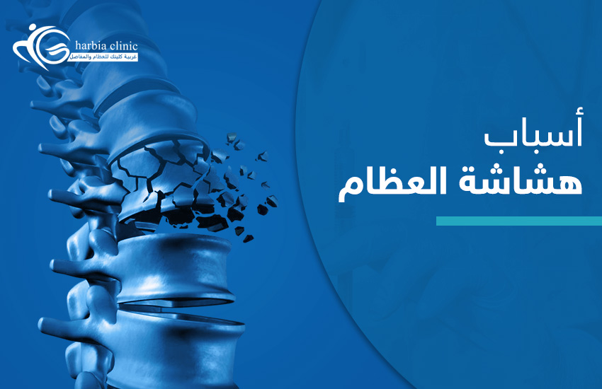 اسباب هشاشة العظام