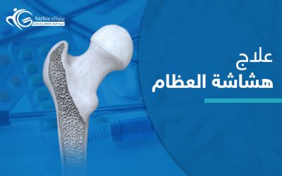 أفضل وسائل علاج هشاشة العظام