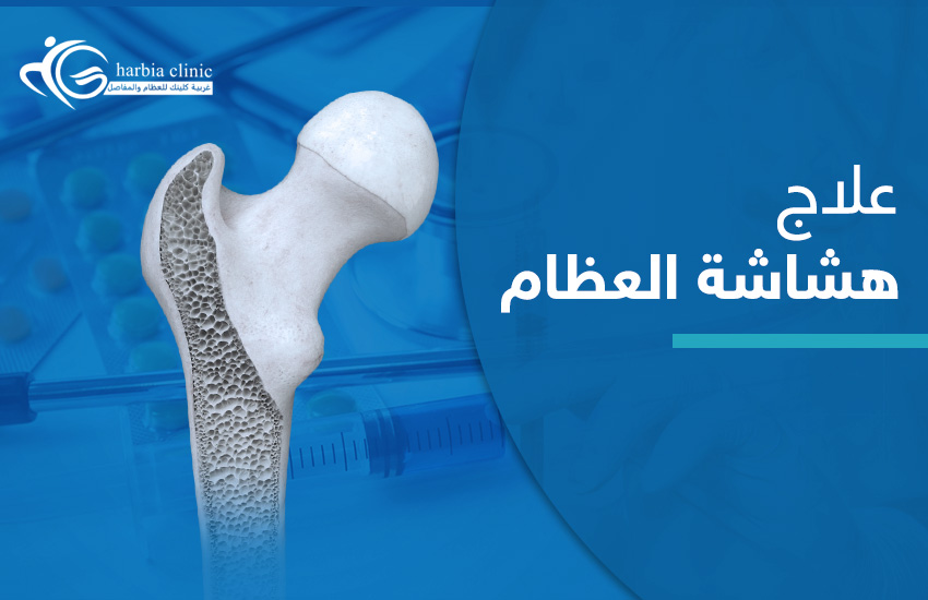 علاج هشاشة العظام