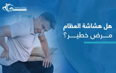 هل هشاشة العظام مرض خطير؟