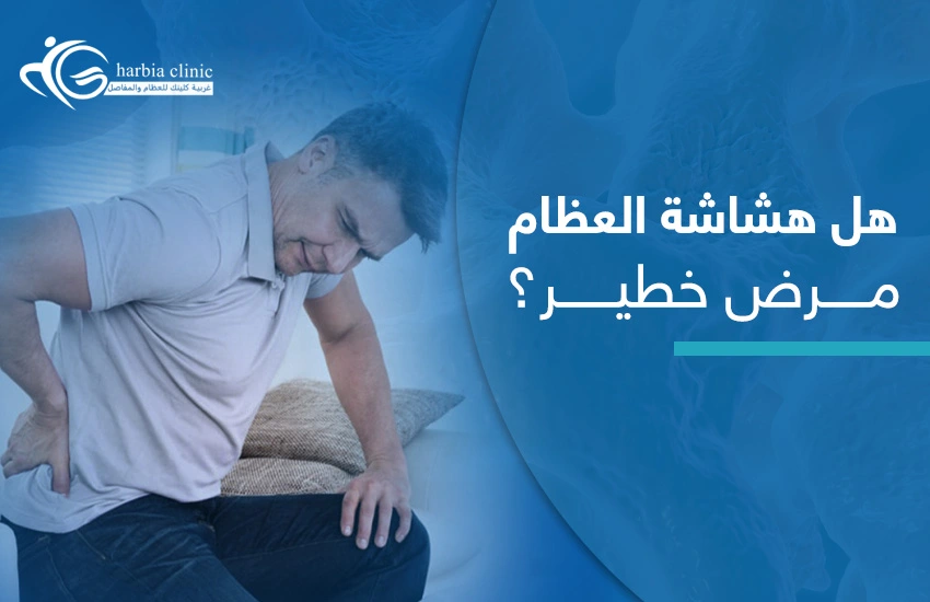 هل-هشاشة-العظام-مرض-خطير هل هشاشة العظام مرض خطير