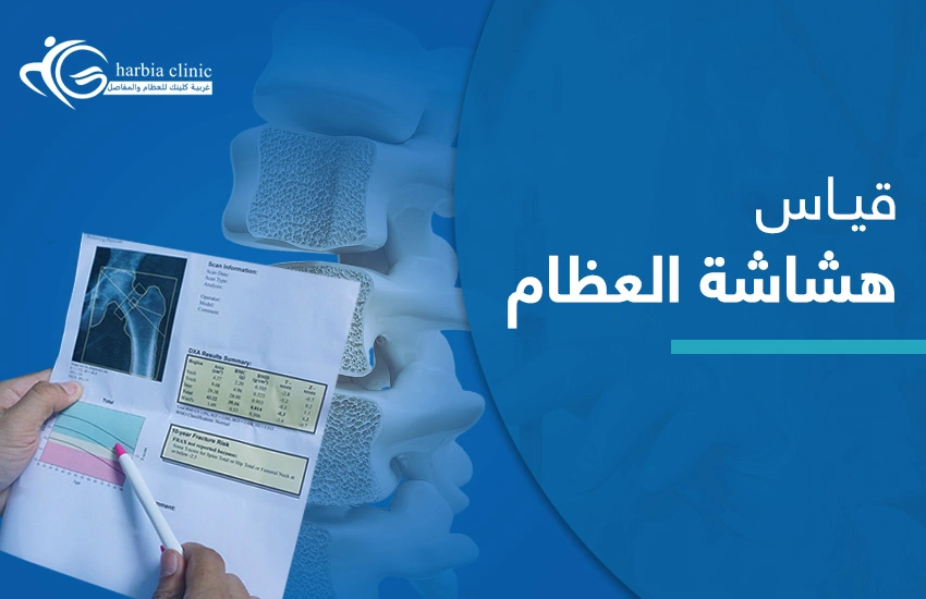 قياس هشاشة العظام