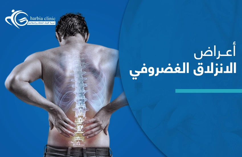 أعراض الانزلاق الغضروفي