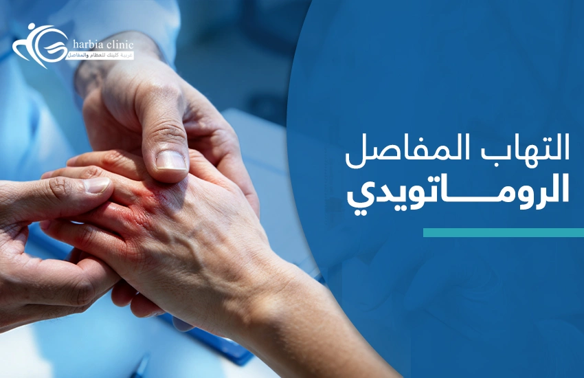 التهاب المفاصل الروماتويدي