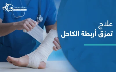 علاج تمزق أربطة الكاحل: أساليب متنوعة لمختلف درجات الإصابة
