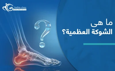 ما هي الشوكة العظمية؟ وما الأسباب التي تؤدي للإصابة بها؟