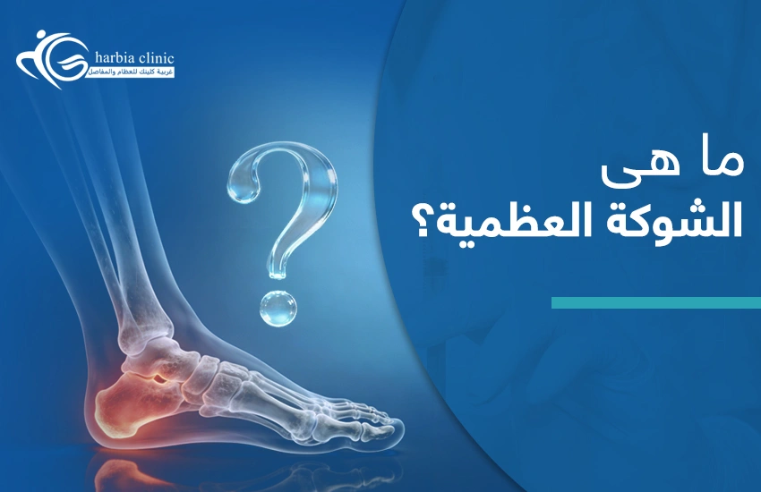 ما هي الشوكة العظمية