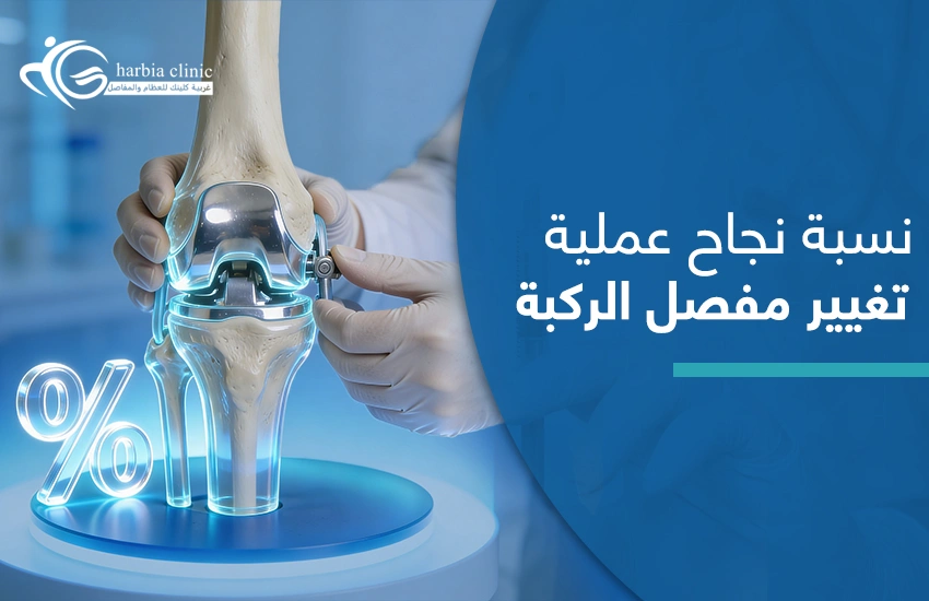 نسبة نجاح عملية تغيير مفصل الركبة